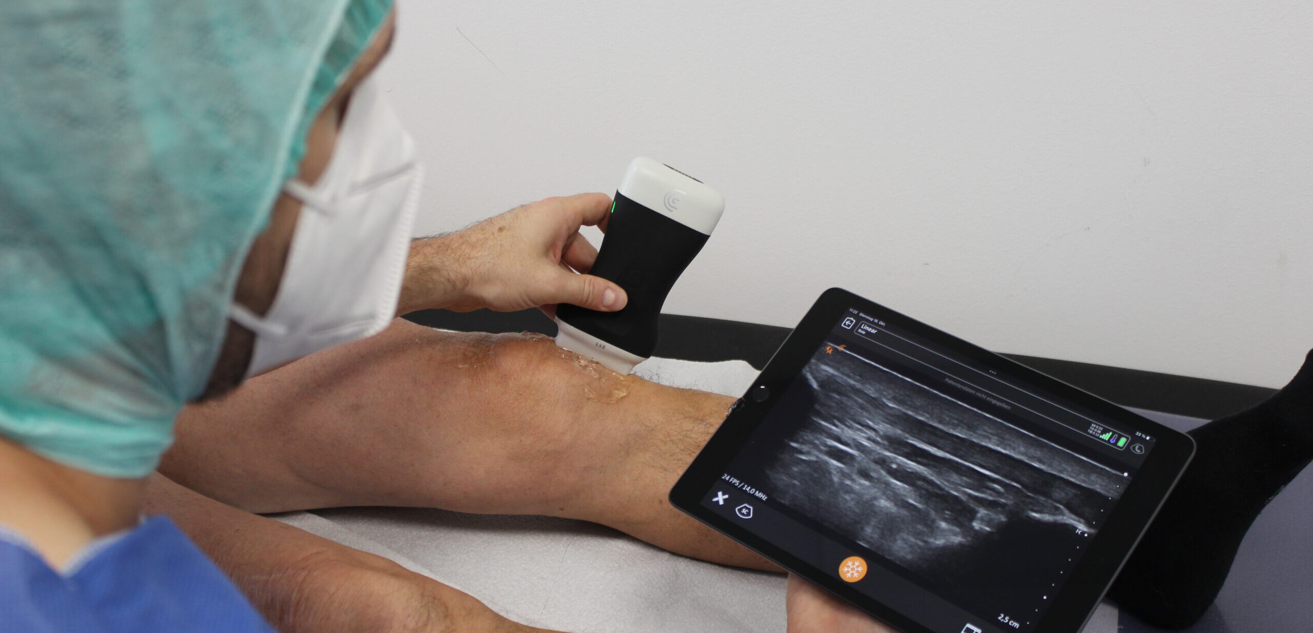 Ein kabelloses Ultraschallgerät. Das Bild wird auf einem Tablet angezeigt.